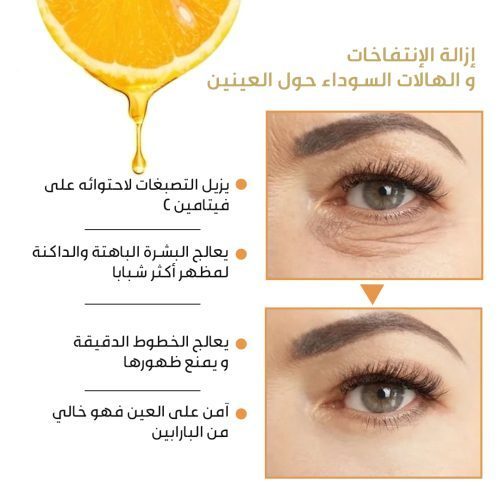 Roller-Eye-Cream-3-AR-ql126rqhm33s88b7n4r7mw8r7d8eole239buo0bwco-r0h8hl9bdltqljzyfm78abbve5vp5tme9z7peksya0